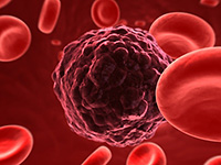 Blut mit Tumorzelle